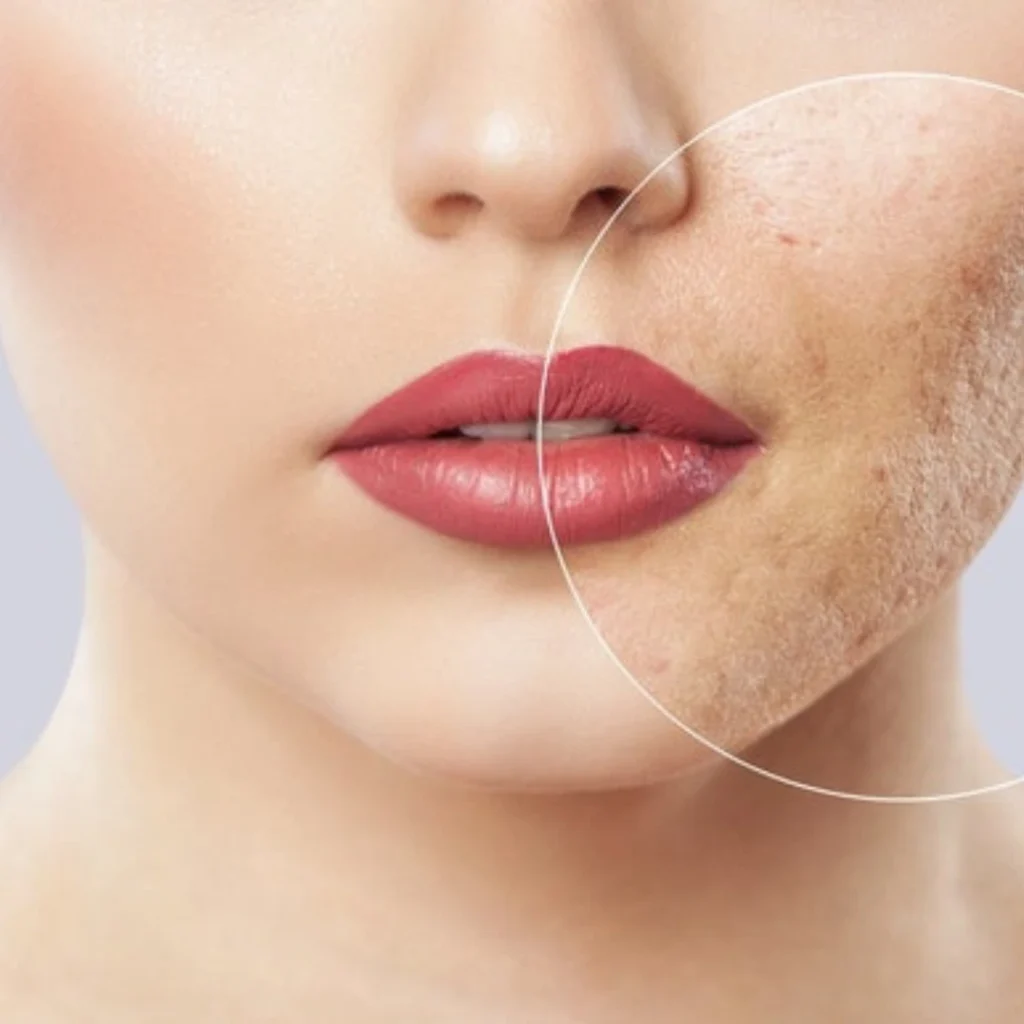 Get naturally glowing skin — no blur filters